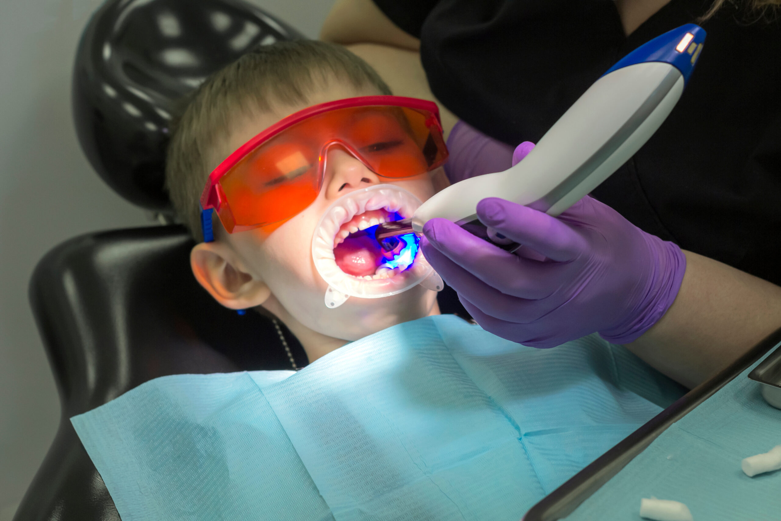laser dentistry in Torrance CA
